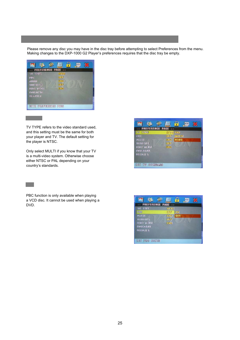 Tv type, Reference | Avayon DXP-1000 G2 User Manual | Page 25 / 39