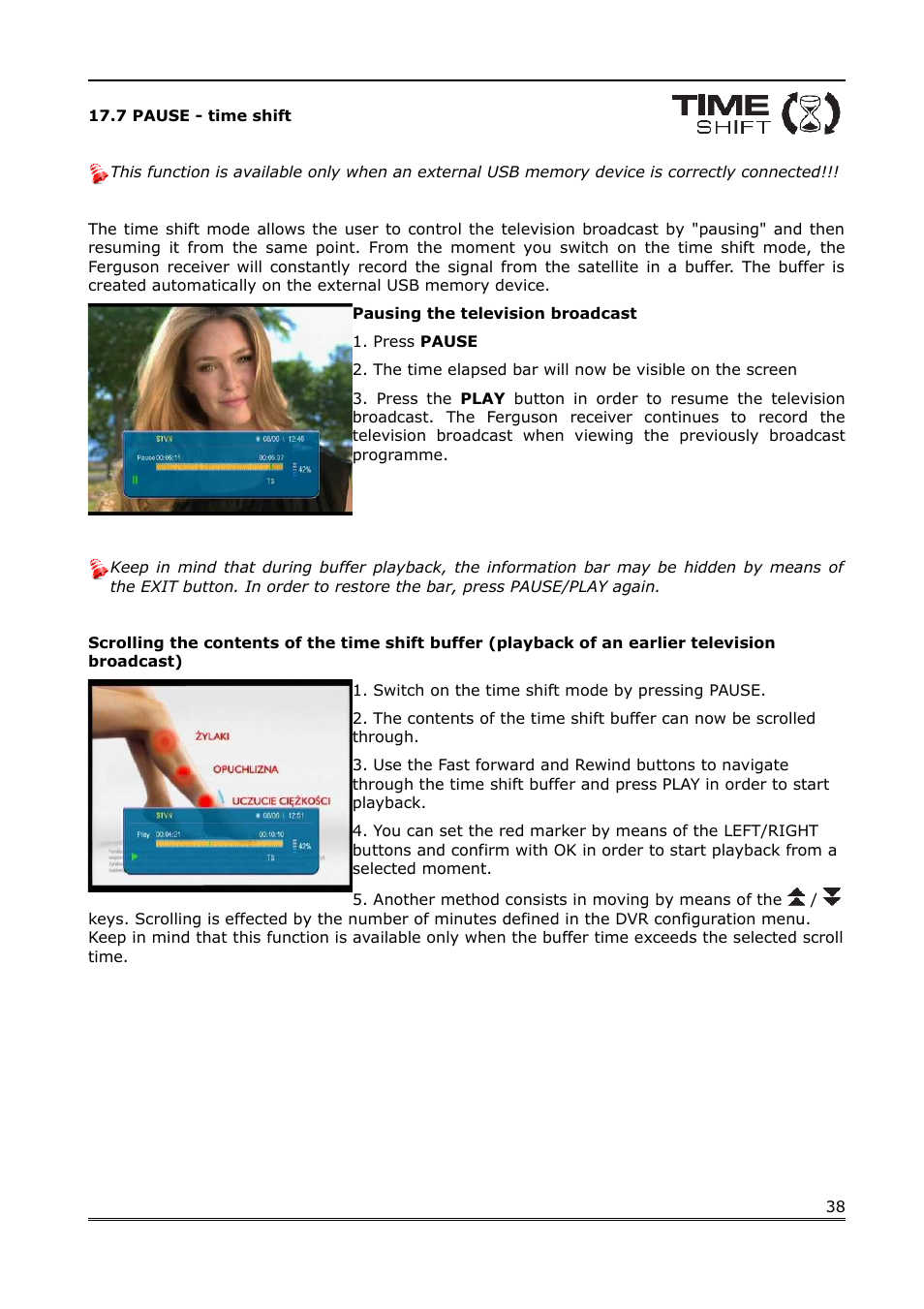 7 pause - time shift | Ferguson Ariva 100E User Manual | Page 38 / 41
