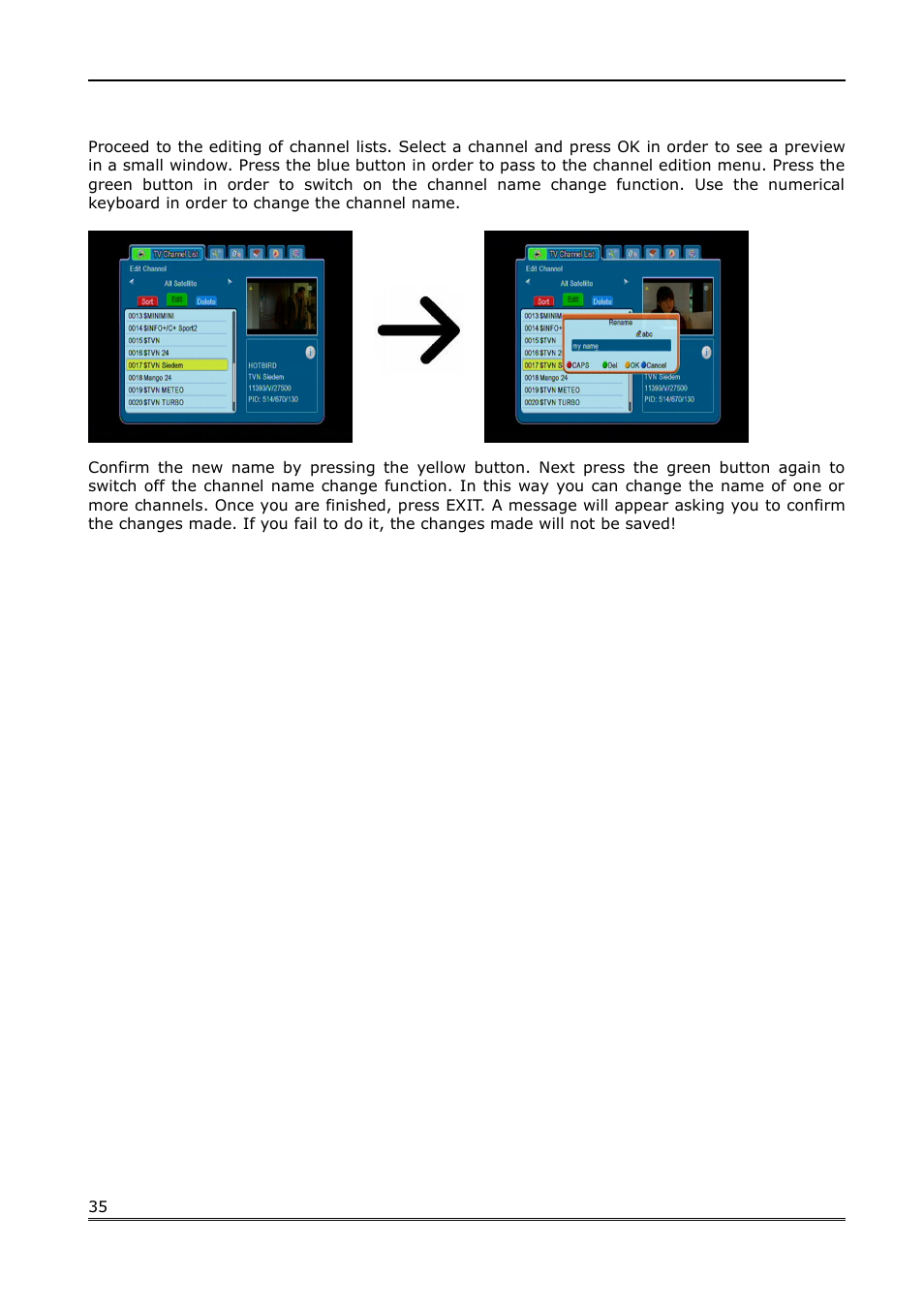 Ferguson FK-7000 User Manual | Page 35 / 44