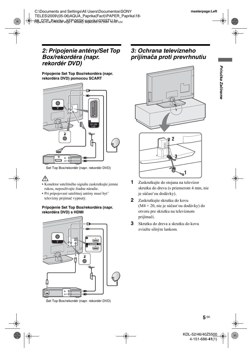 Ochrana televízneho prijímaèa proti prevrhnutiu, Ochrana televízneho prijímača proti prevrhnutiu | Sony KDL-52Z5800 User Manual | Page 129 / 175