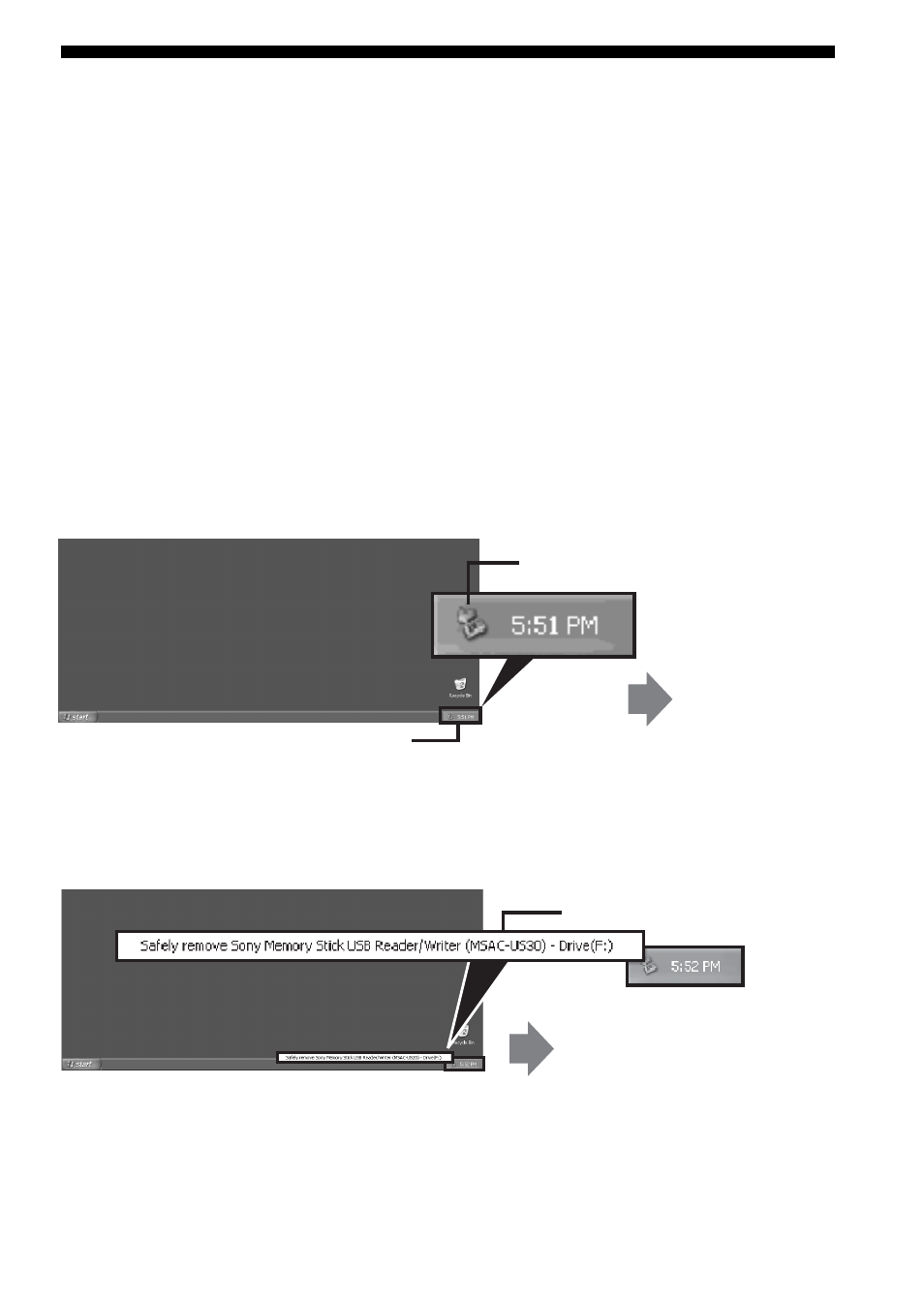 Urkoppling av enheten från datorn | Sony MSAC-US30 User Manual | Page 435 / 790