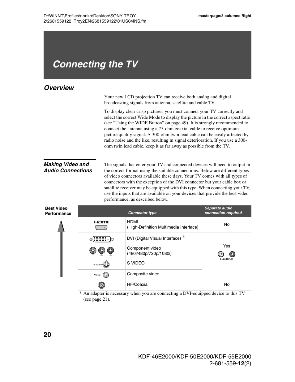 Connecting the tv, Overview, Making video and audio connections | Sony KDF-50X30 User Manual | Page 20 / 90