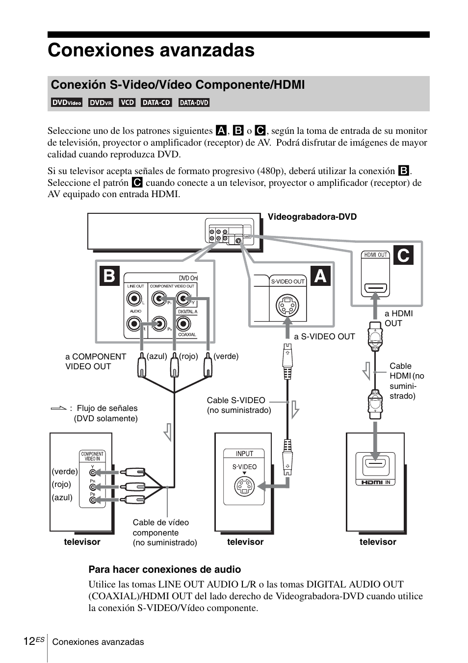 Conexiones avanzadas, A configuraci, Conexión s-video/vídeo componente/hdmi | Sony SLV-D570H User Manual | Page 132 / 140