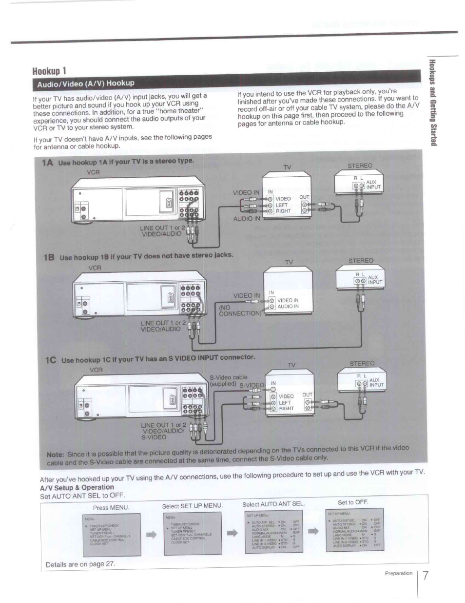 Audio/video (a/v) hookup, 1a use hookup 1a if your tv is a stereo type, Hookup 1 - audio/video (a/v) hookup | Hookup 1 | Sony SLV-R1000 User Manual | Page 7 / 76