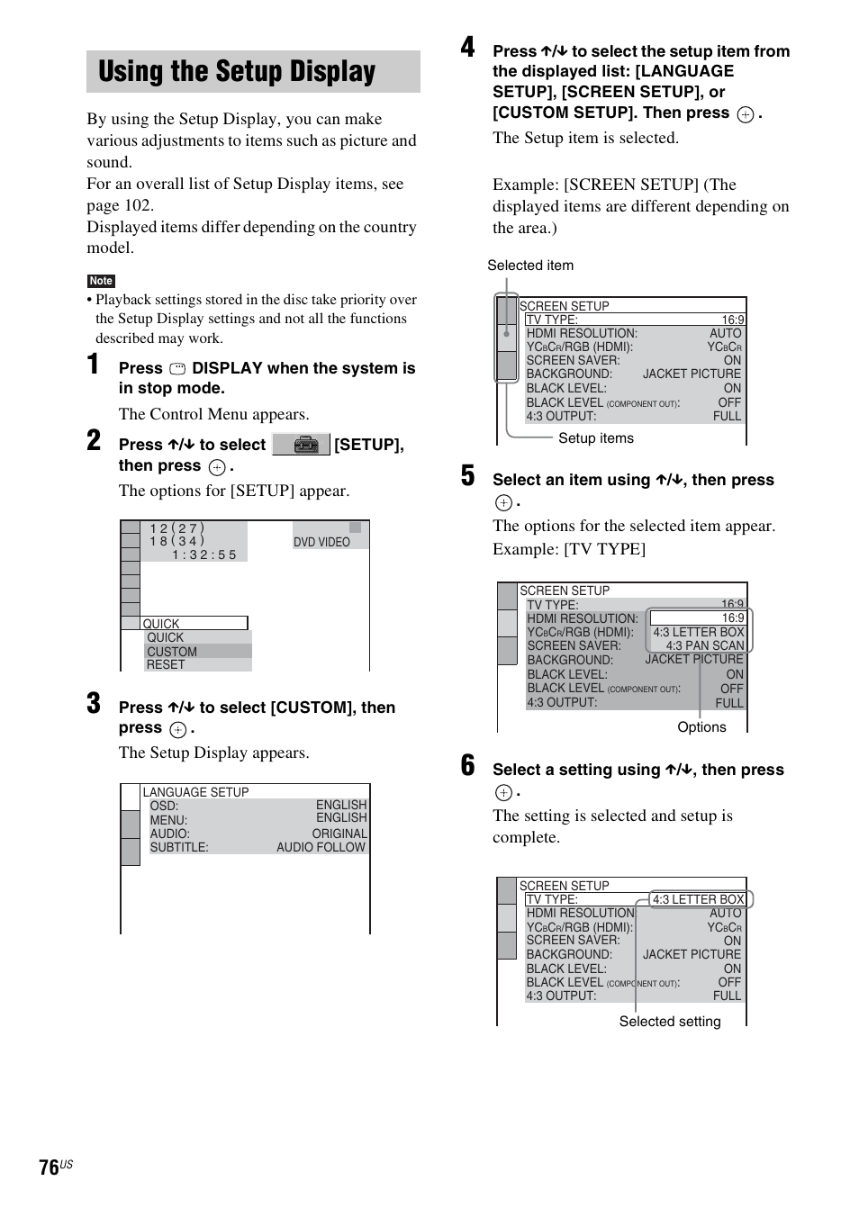 Using the setup display, The control menu appears, The options for [setup] appear | The setup display appears, The setting is selected and setup is complete | Sony DAV-X1V User Manual | Page 76 / 107