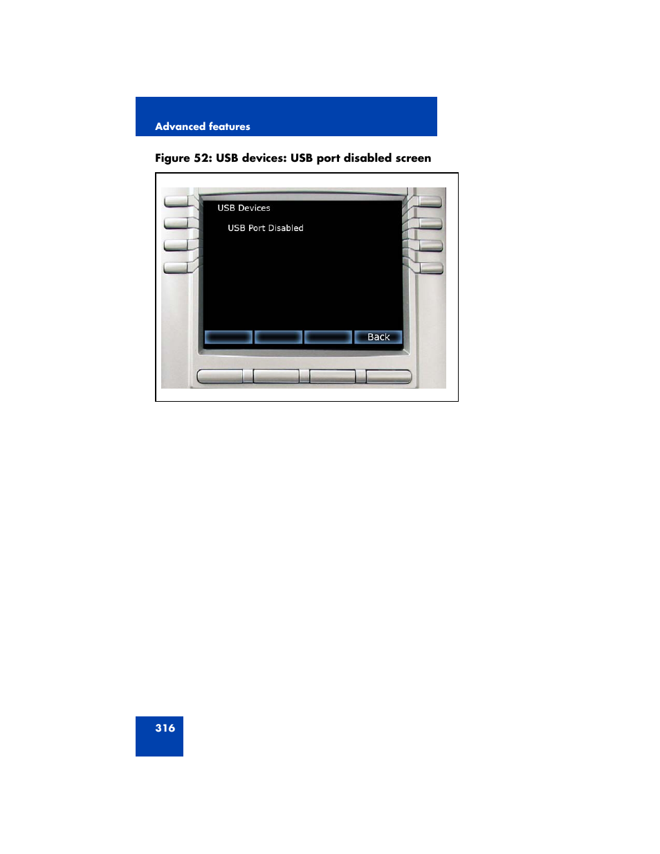 Avaya NN43170-100 User Manual | Page 316 / 378