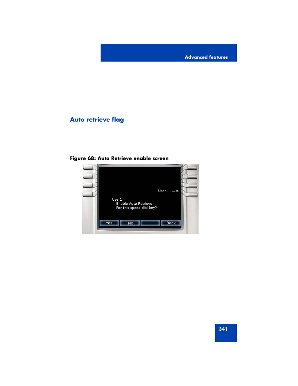 Auto retrieve flag | Avaya NN43170-100 User Manual | Page 341 / 378