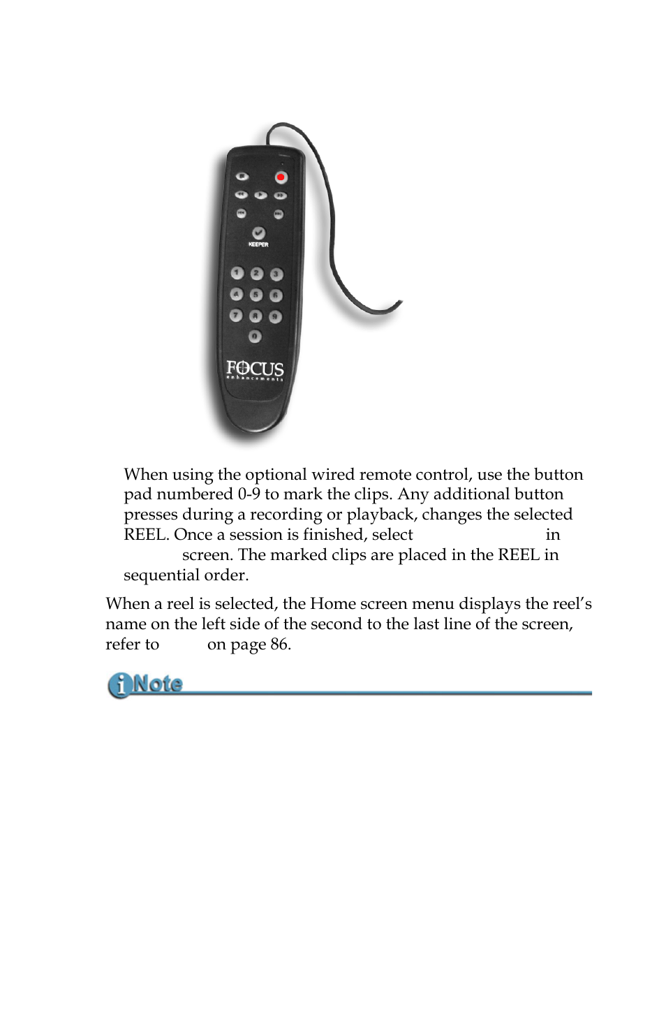Using a wired remote control | Panasonic FS-100 User Manual | Page 101 / 154