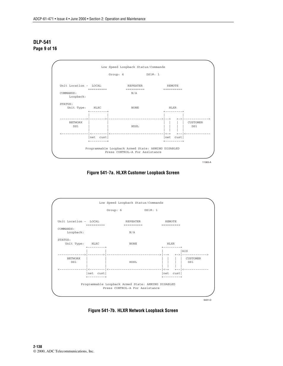 Figure 541-7a, Figure 541-7b, Dlp-541 | Page 9 of 16, Figure 541-7a. hlxr, Customer loopback screen, Figure 541-7b. hlxr, Network loopback screen | ADC Soneplex Broadband System User Manual | Page 161 / 342