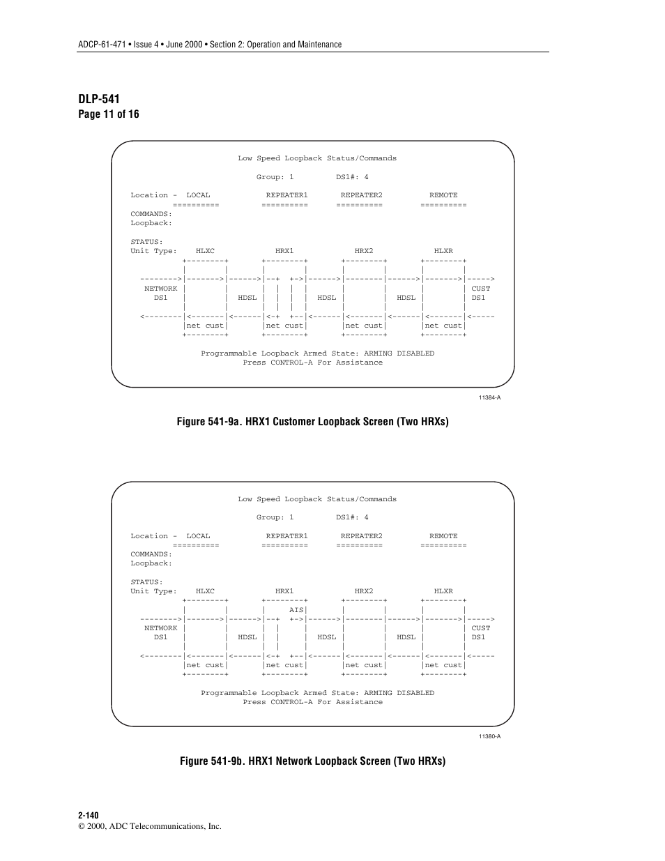 Figure 541-9a, Figure 541-9b, Dlp-541 | Page 11 of 16, Customer loopback screen (two hrxs), Network loopback screen (two hrxs) | ADC Soneplex Broadband System User Manual | Page 163 / 342