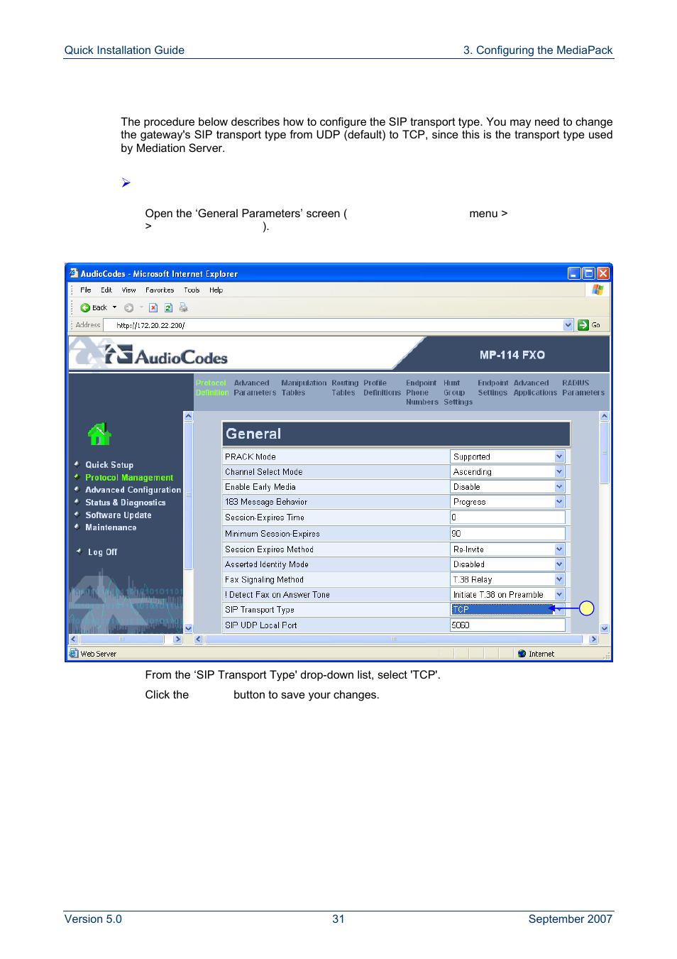Defining sip transport type | AudioCodes MP-118 User Manual | Page 31 / 44