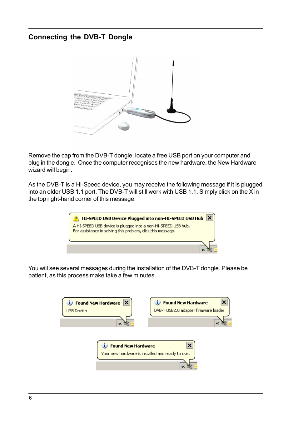 Toshiba DVB-T Tuner User Manual | Page 6 / 19