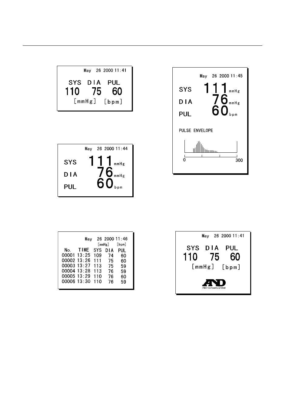 3 printing samples | A&D Automatic Blood Pressure Monitor TM-2655P User Manual | Page 22 / 30