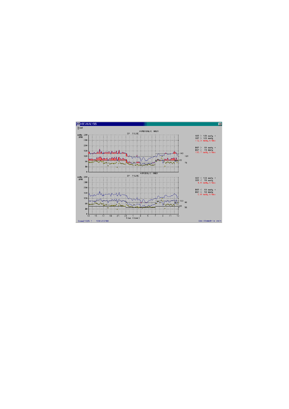 Hib analysis, 6-7 hib analysis | A&D TM-2430-13 User Manual | Page 30 / 69