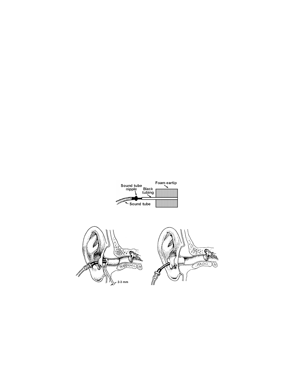 Aearo Company E-A-RTONE 3A User Manual | Page 3 / 9