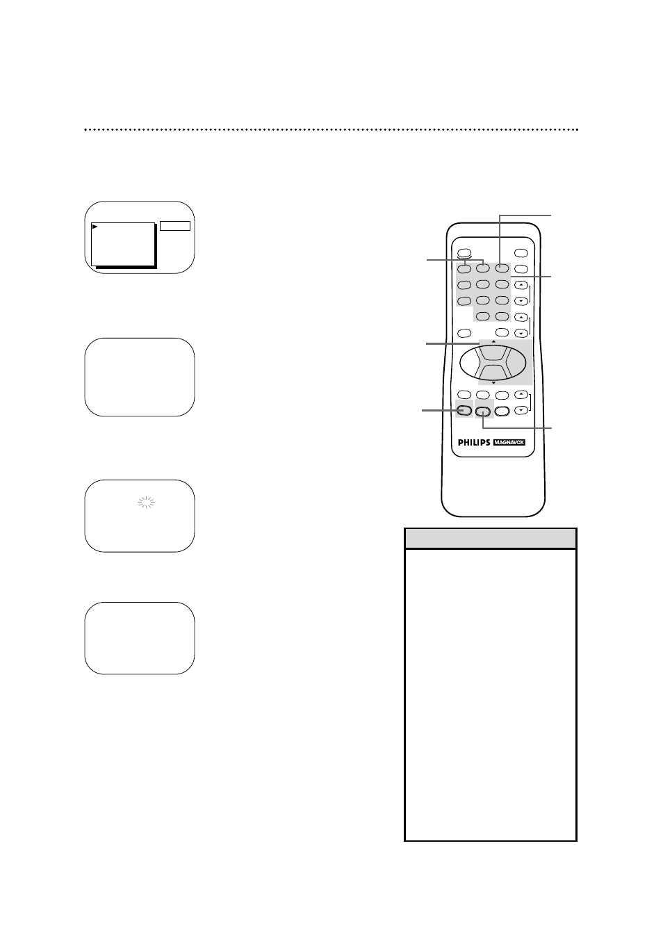 Philips CCX252AT99 User Manual | Page 11 / 52