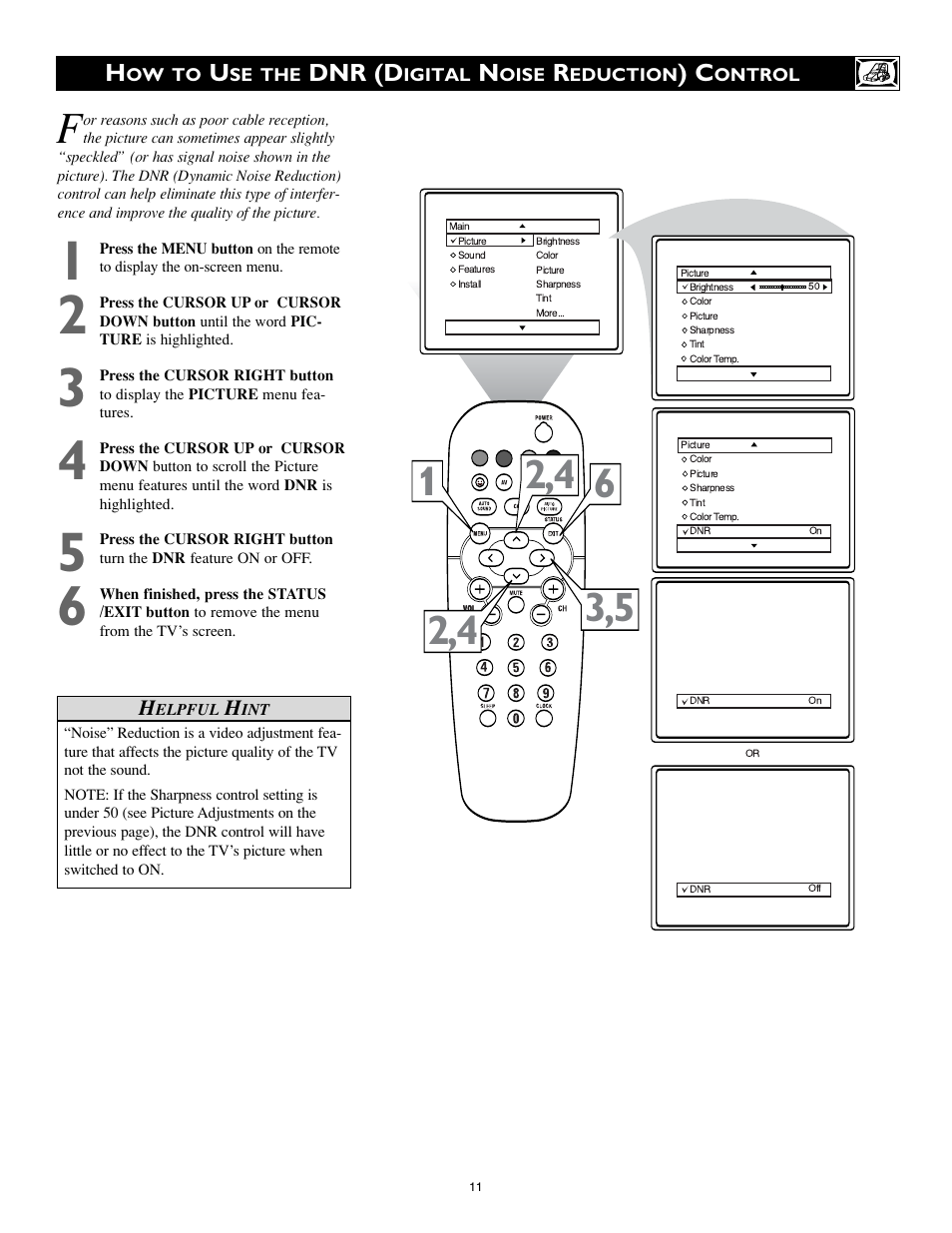Philips 20RF50S User Manual | Page 11 / 40