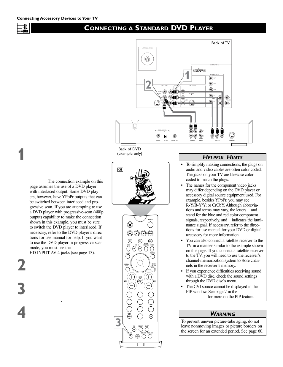 Dvd p, Onnecting a, Tandard | Layer, Elpful, Ints, Arning | Philips 51 in Digital Widescreen HDTV Monitor User Manual | Page 12 / 72