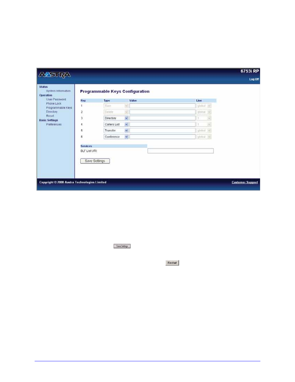 Setting a do not disturb (dnd) key, Advanced phone features | Aastra Telecom AastraLink RP CT Cordless User Manual | Page 70 / 110