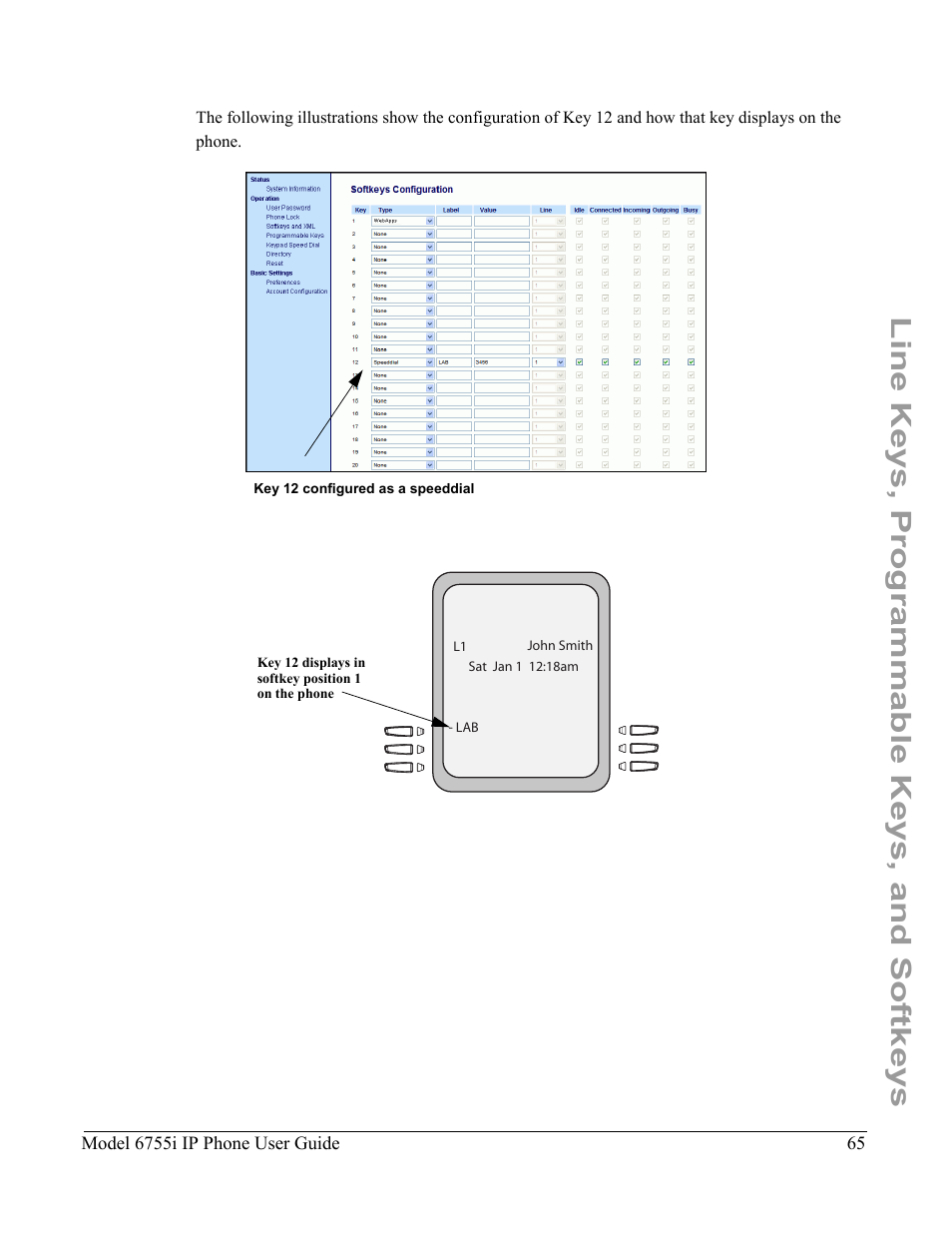 Line keys, programmable keys, and softkeys | Aastra Telecom 6755i User Manual | Page 73 / 276