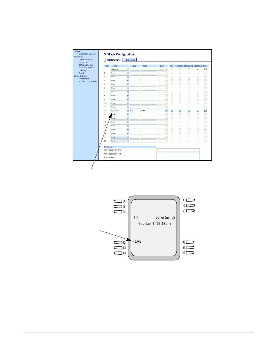 Line keys and softkeys | Aastra Telecom 6757I User Manual | Page 73 / 276