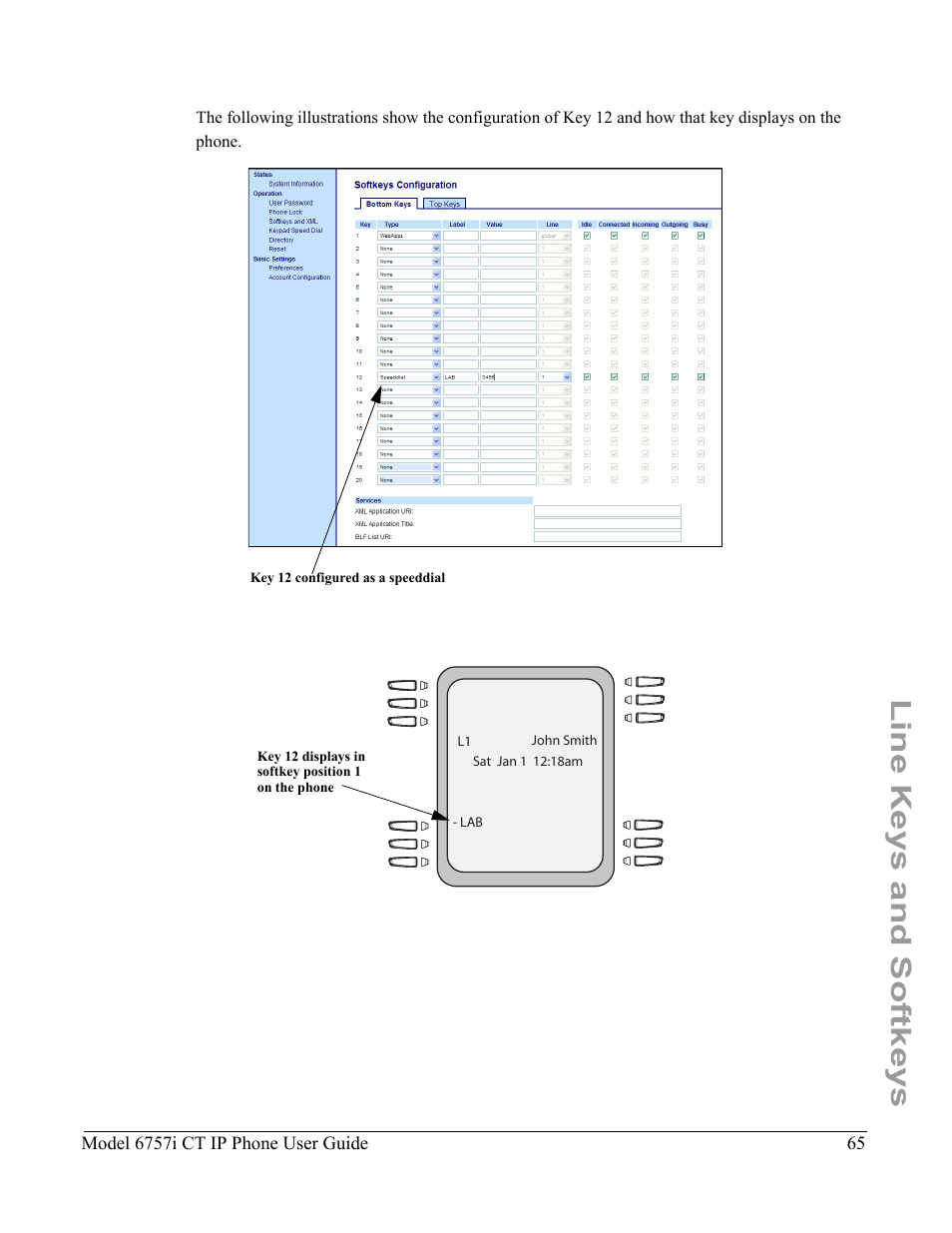 Line keys and softkeys | Aastra Telecom 6757I CT User Manual | Page 75 / 310