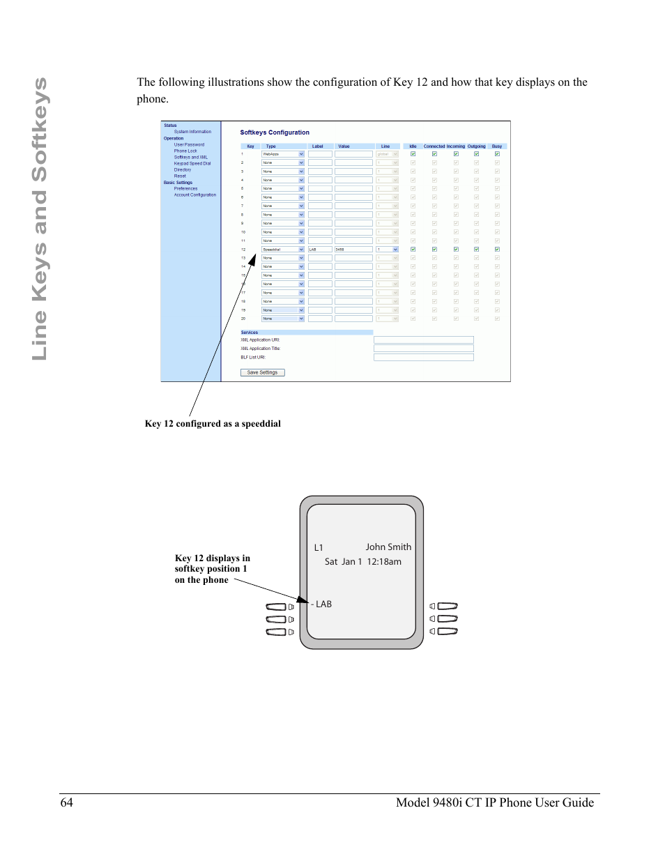 Line keys and softkeys | Aastra Telecom 9480i CT User Manual | Page 74 / 290