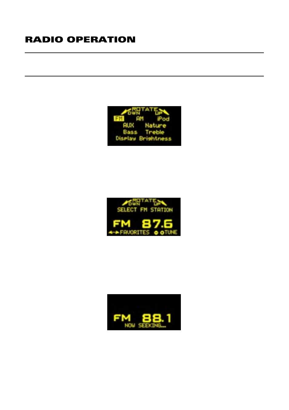 Art1, Radio operation | Acoustic Research ART1 User Manual | Page 18 / 64