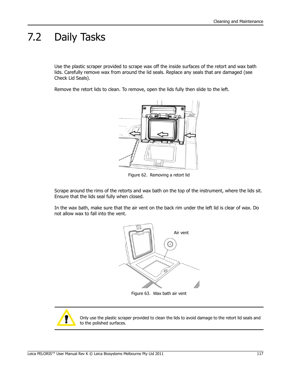 2 daily tasks, Daily tasks, Clean lids and seals in 7.2 daily tasks) | Clean lids and seals | Leica Biosystems PELORIS_PELORIS II User Manual | Page 117 / 160