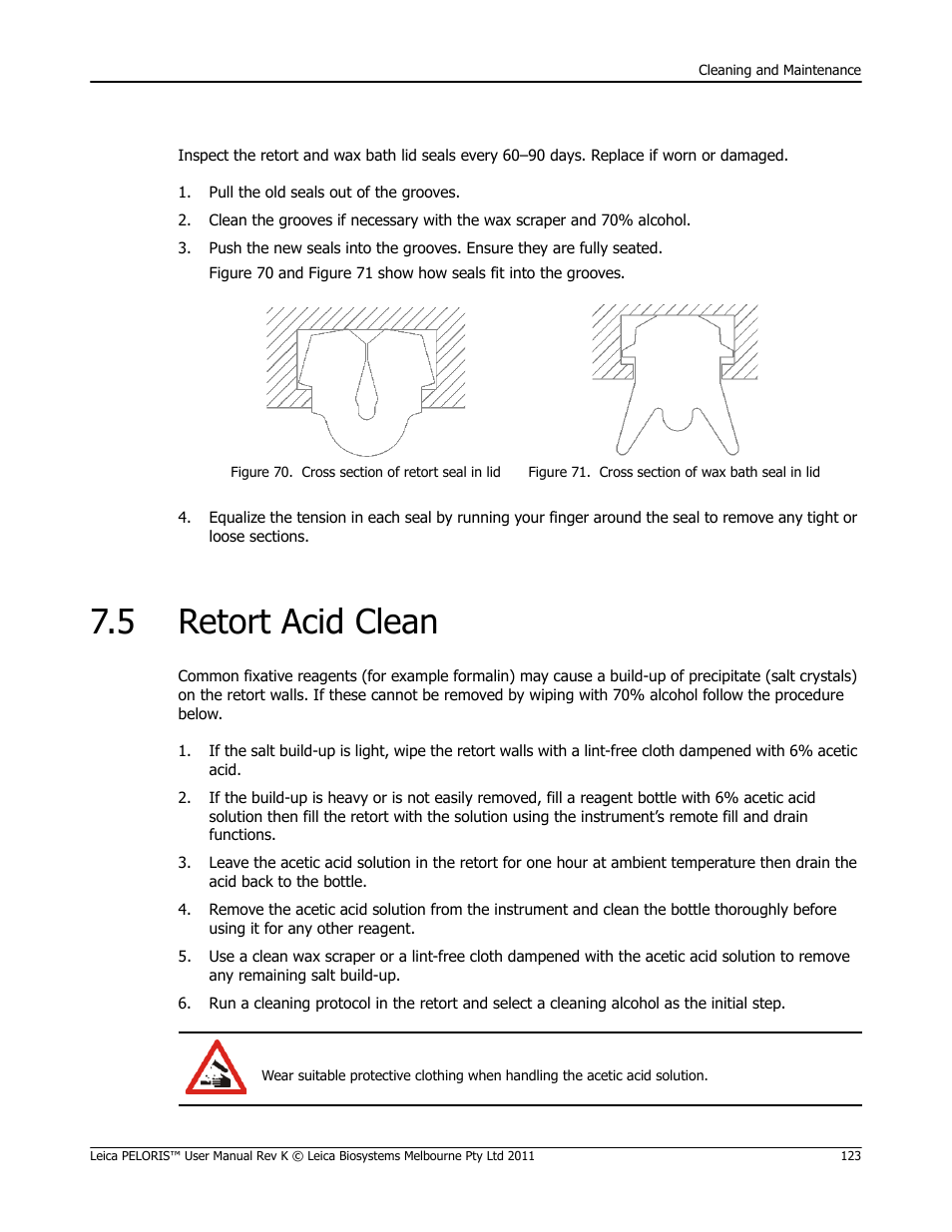 5 retort acid clean, Retort acid clean, Check lid seals | Leica Biosystems PELORIS_PELORIS II User Manual | Page 123 / 160