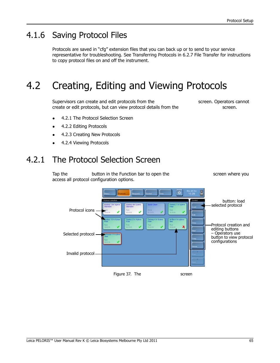 6 saving protocol files, 2 creating, editing and viewing protocols, 1 the protocol selection screen | Saving protocol files, 2 creating, editing, And viewing protocols, 2 creating, editing and viewing, Protocols | Leica Biosystems PELORIS_PELORIS II User Manual | Page 65 / 160