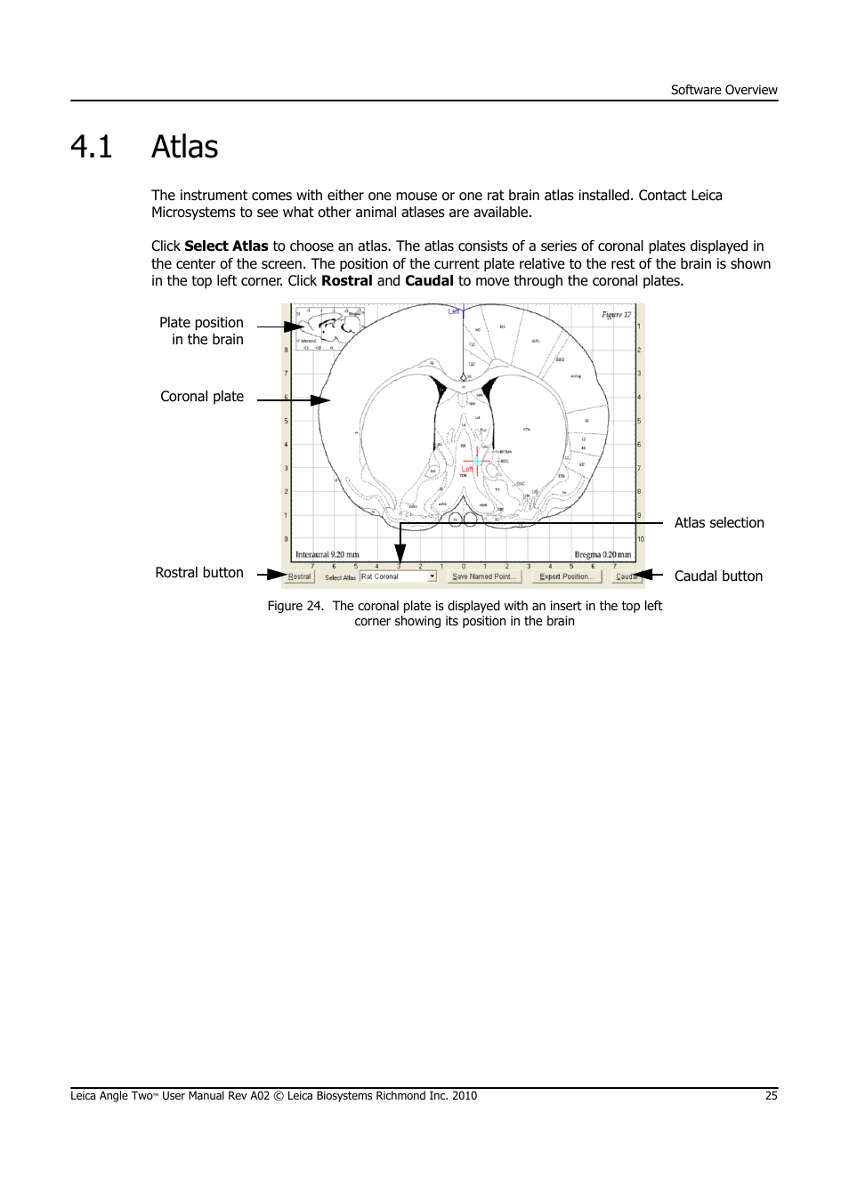 1 atlas, Atlas | Leica Biosystems ANGLE TWO User Manual | Page 25 / 50
