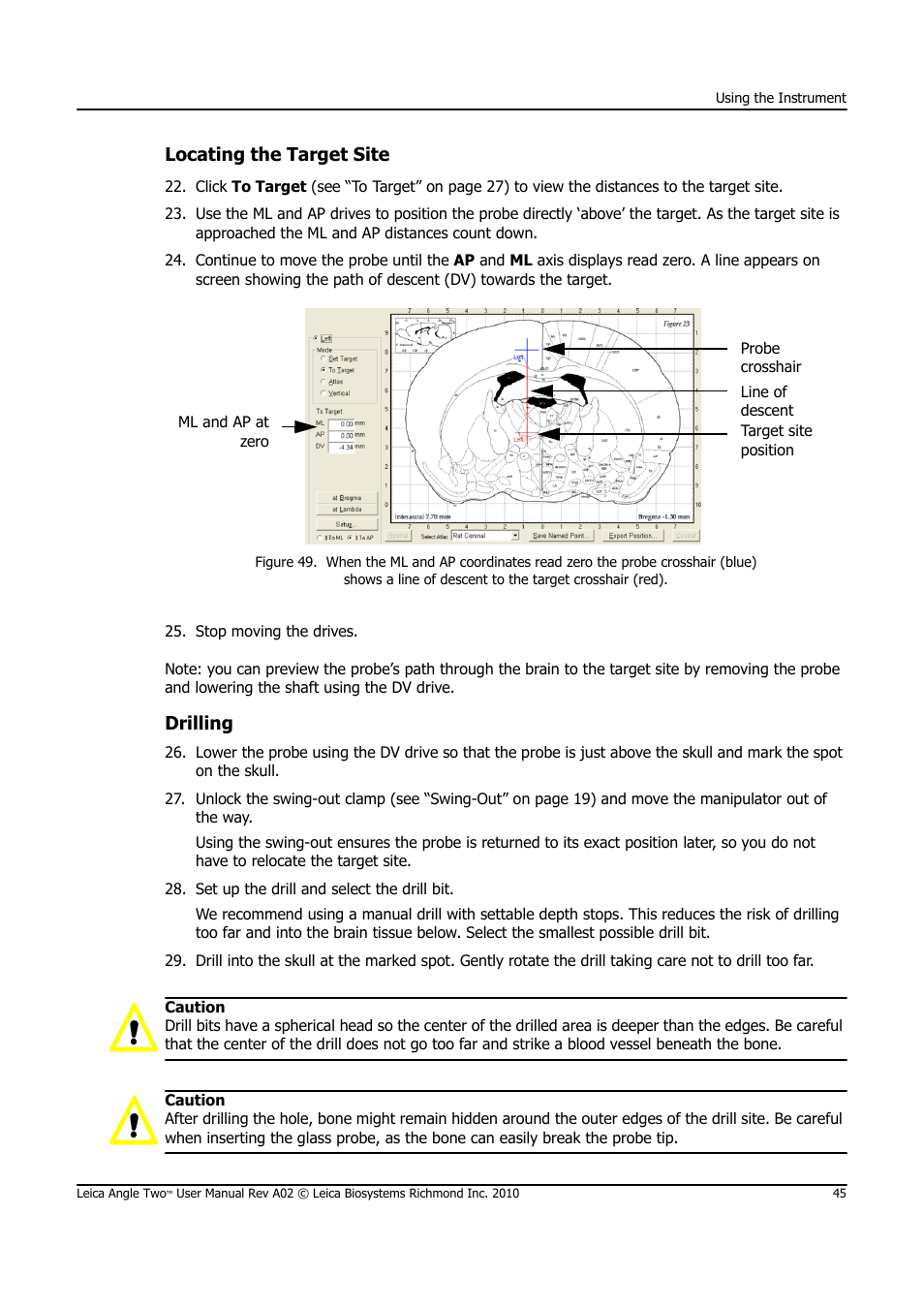 Locating the target site, Drilling | Leica Biosystems ANGLE TWO User Manual | Page 45 / 50