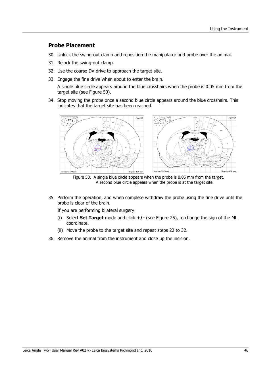 Probe placement | Leica Biosystems ANGLE TWO User Manual | Page 46 / 50