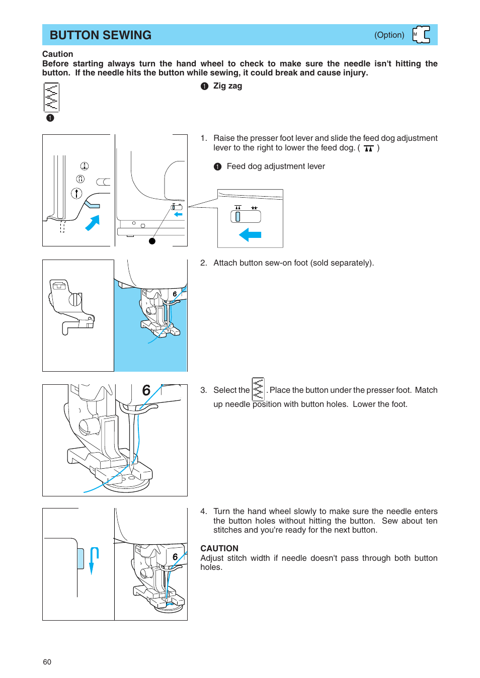 Button sewing | Brother PE 400D User Manual | Page 63 / 112