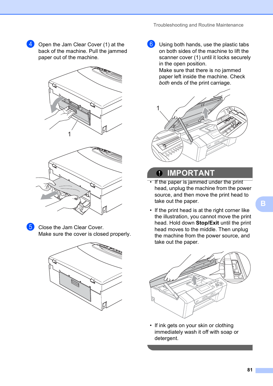 Important | Brother DCP-395CN User Manual | Page 89 / 130