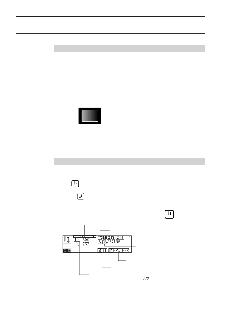 Sewing operation, Before starting sewing, Starting sewing operation | Brother BES-1261BC User Manual | Page 74 / 164