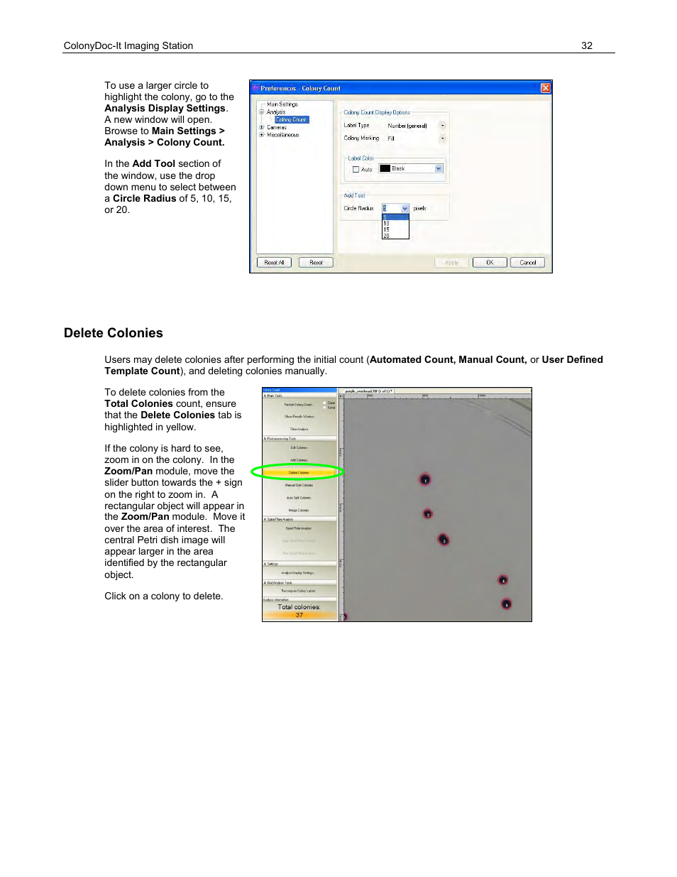 Delete colonies | UVP ColonyDoc-It Imaging Station User Manual | Page 32 / 48
