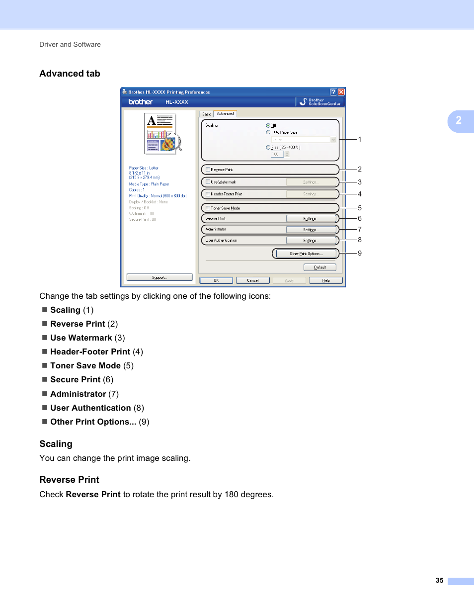 Advanced tab, Scaling, Reverse print | Brother HL 4150CDN User Manual | Page 41 / 199