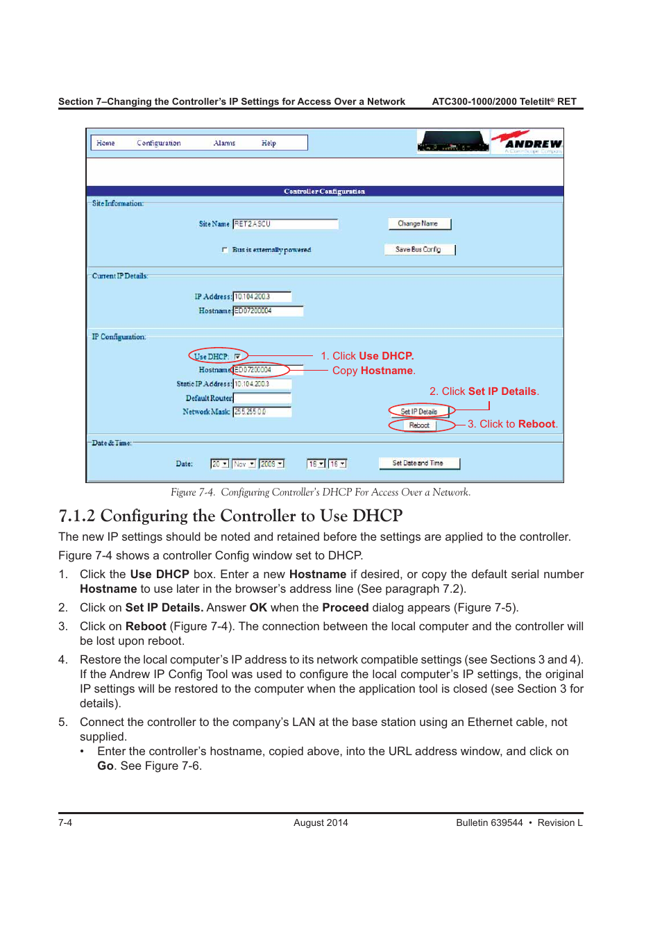 2 configuring the controller to use dhcp | CommScope ATC300-2000 User Manual | Page 75 / 214