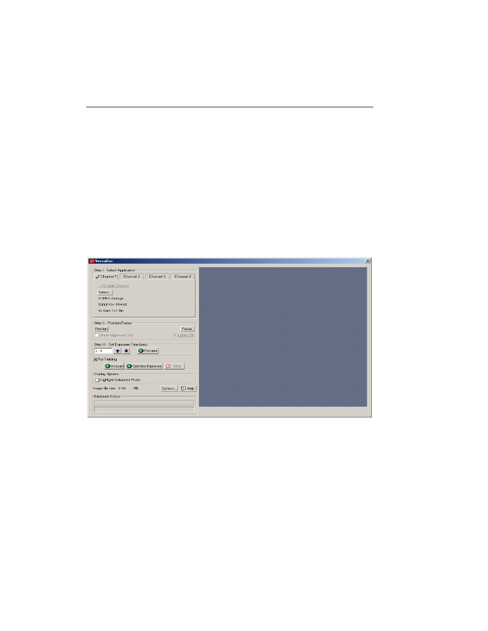 K.1 versadoc acquisition window | Bio-Rad EXQuest Spot Cutter User Manual | Page 509 / 564