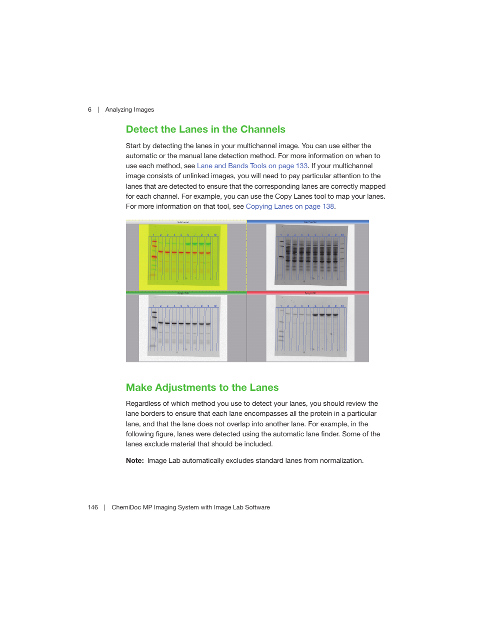Detect the lanes in the channels, Make adjustments to the lanes | Bio-Rad Image Lab™ Software User Manual | Page 146 / 260