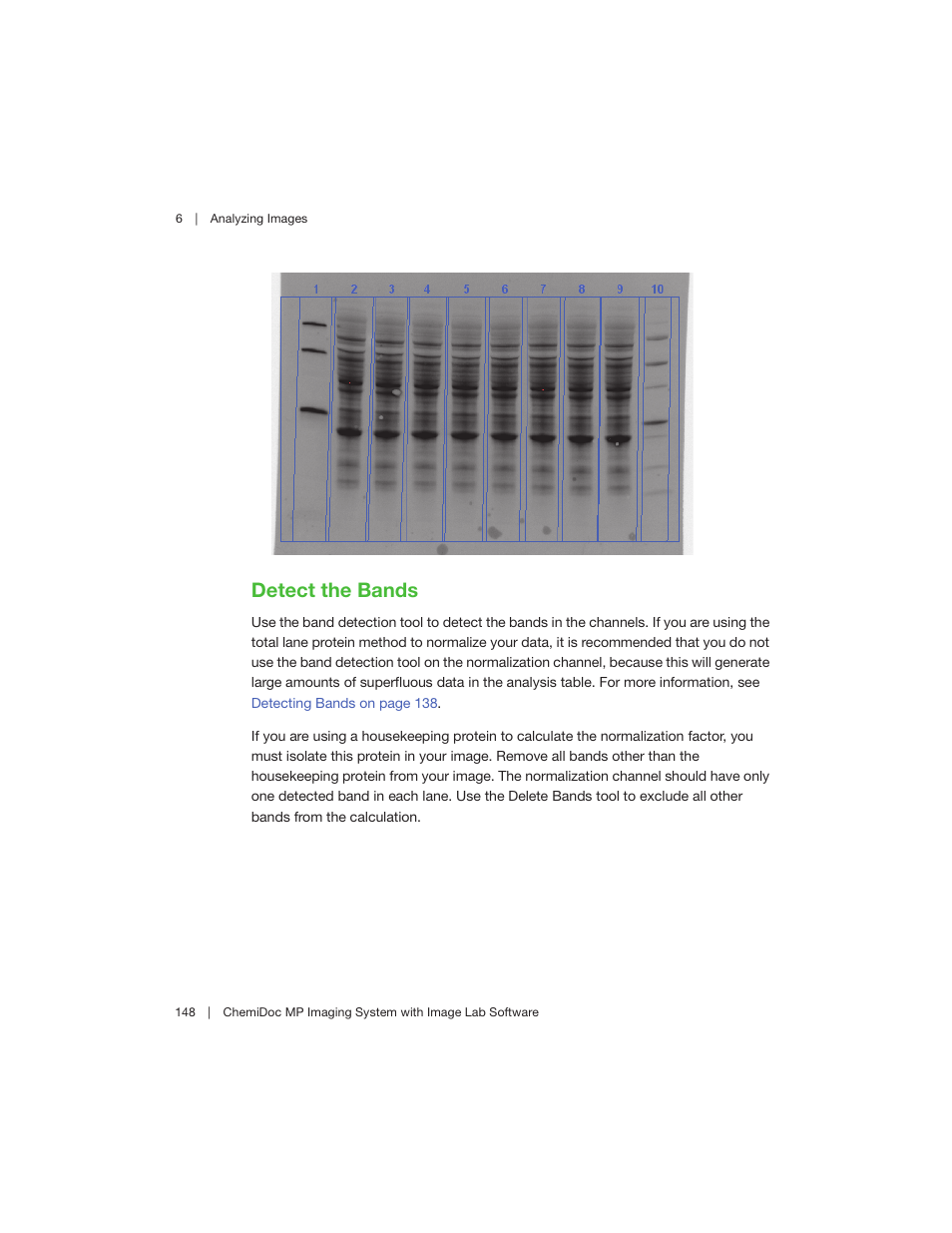 Detect the bands | Bio-Rad Image Lab™ Software User Manual | Page 148 / 260
