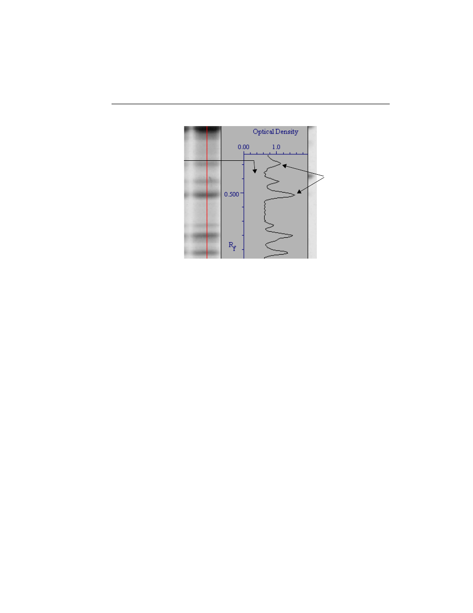 2 lane-based background subtraction, Lane-based background subtraction -9 | Bio-Rad Quantity One 1-D Analysis Software User Manual | Page 106 / 444