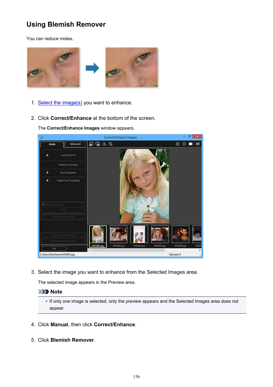 Using blemish remover | Canon My Image Garden User Manual | Page 156 / 308