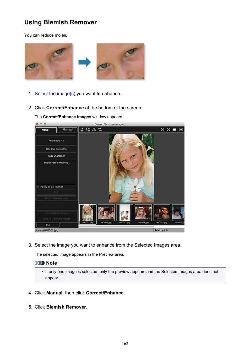 Using blemish remover | Canon My Image Garden User Manual | Page 162 / 304
