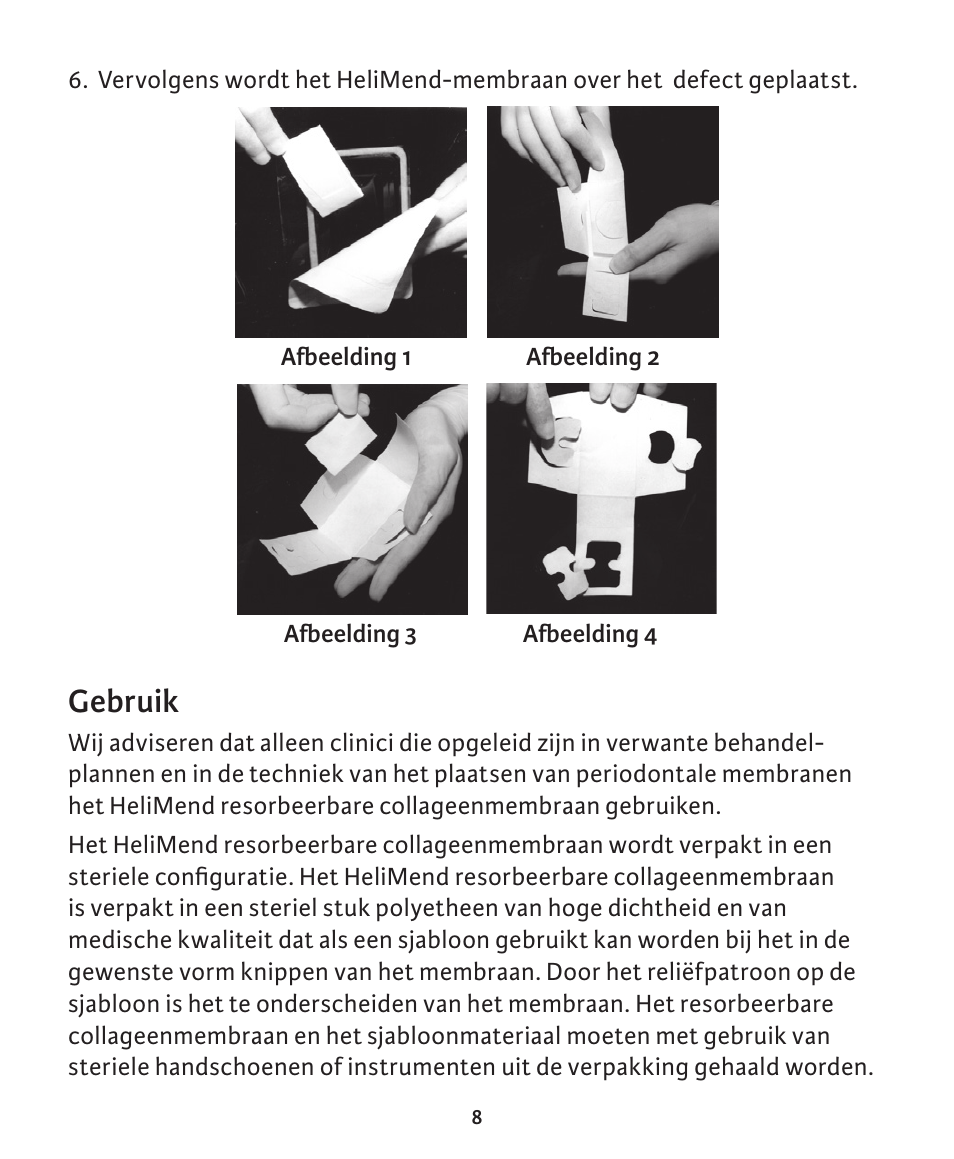 Gebruik | Integra LifeSciences Collagen Membrane, HeliMend  User Manual | Page 62 / 65