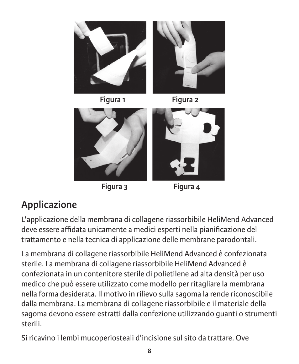 Applicazione | Integra LifeSciences Collagen Membrane, HeliMend Advanced  User Manual | Page 51 / 65