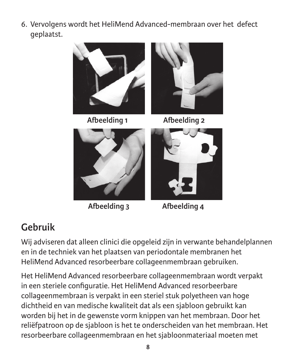 Gebruik | Integra LifeSciences Collagen Membrane, HeliMend Advanced  User Manual | Page 62 / 65