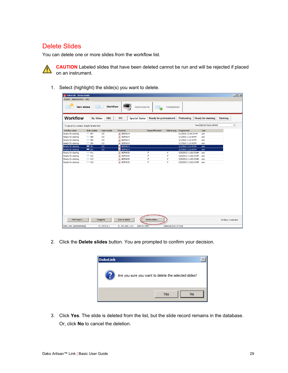 Delete slides | Dako Artisan™ Link Pro User Manual | Page 37 / 90